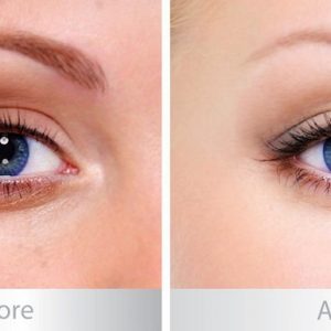 MẮT ( EYES )